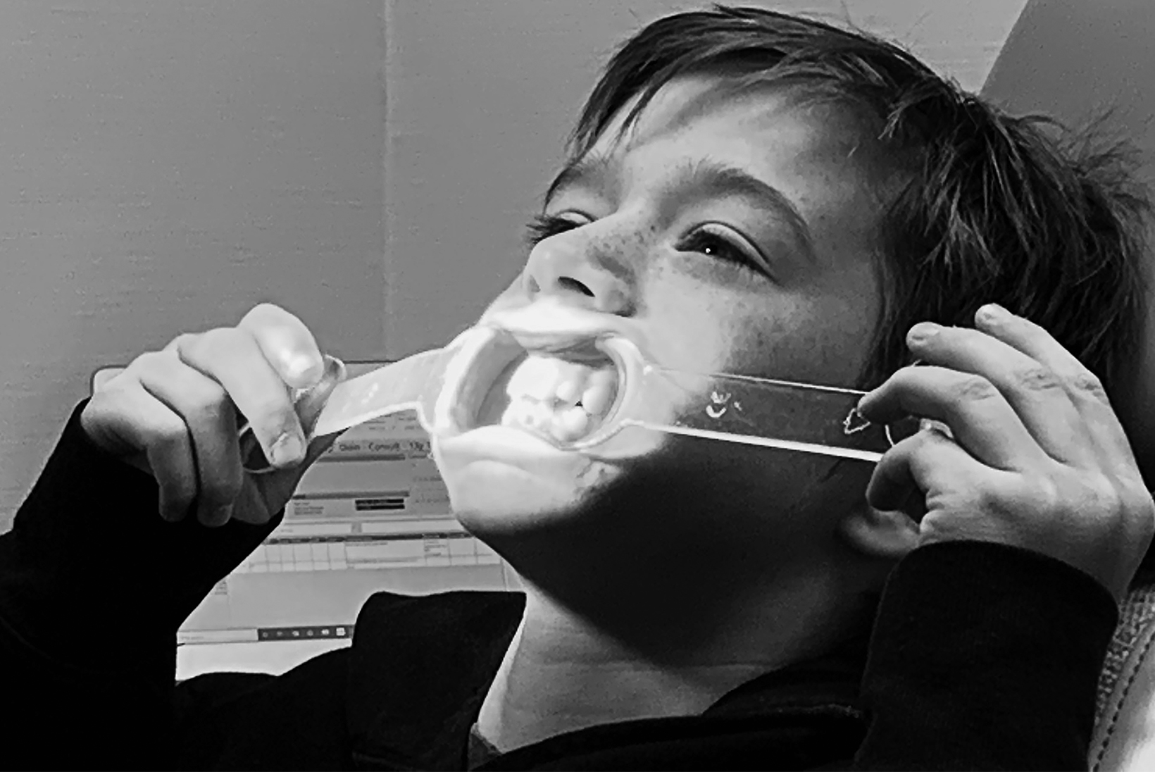 A close-up of a young boy with freckles in a dentist chair. He has a dental mouth opener in his mouth and is holding the sides with his hands.